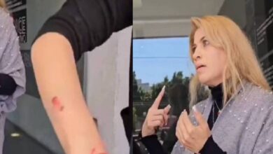 Mujer ataca con mordiscos a manicurista para no pagarle